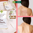 Xịt Trị Mụn Lưng For Back
